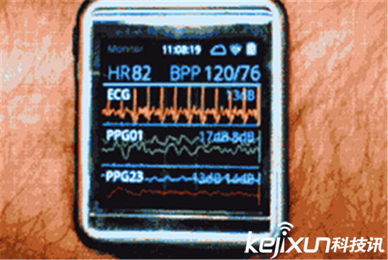 你真的需要一塊iwatch？iwatch功能介紹
