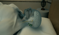 Snore Circle智能止鼾設(shè)備登錄眾籌：終于能睡個(gè)好覺