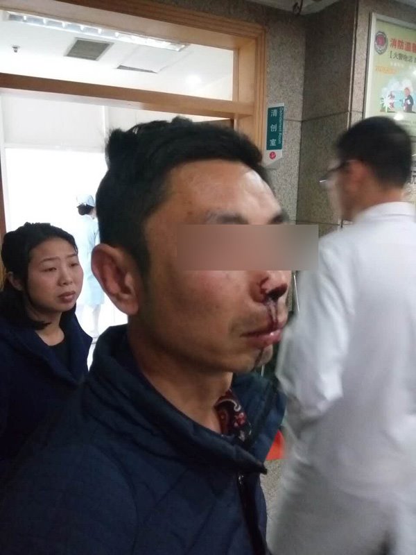 快遞員稱叫收件人實名簽收遭暴打，警方：已立案調(diào)查