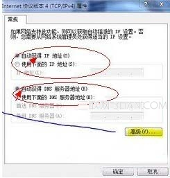 本地連接沒(méi)有有效的ip配置